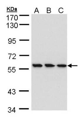 Western Blot: RNGTT Antibody [NBP1-32711] - Sample (30 ug of whole cell lysate) A: HeLa B: Hep G2 C: MOLT4 7.5% SDS PAGE, antibody diluted at 1:1000.