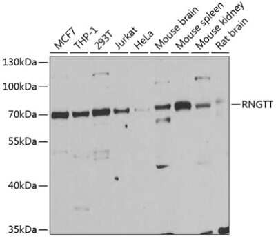 Western Blot: RNGTT Antibody [NBP2-94014] - Analysis of extracts of various cell lines, using RNGTT at 1:1000 dilution. Secondary antibody: HRP Goat Anti-Rabbit IgG (H+L) at 1:10000 dilution. Lysates/proteins: 25ug per lane. Blocking buffer: 3% nonfat dry milk in TBST. Detection: ECL Basic Kit . Exposure time: 90s.