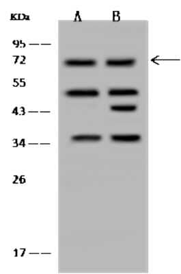 Western Blot: RNGTT Antibody [NBP2-97837] - Anti-RNGTT rabbit polyclonal antibody at 1:500 dilution. Lane A: Jurkat Whole Cell Lysate Lane B: HeLa Whole Cell Lysate Lysates/proteins at 30 ug per lane. Secondary Goat Anti-Rabbit IgG (H+L)/HRP at 1/10000 dilution. Developed using the ECL technique. Performed under reducing conditions. Predicted band size: 69 kDa. Observed band size: 69 kDa (We are unsure as to the identity of these extra bands).