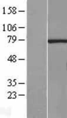 Western Blot: RNGTT Overexpression Lysate (Adult Normal) [NBL1-15461] Left-Empty vector transfected control cell lysate (HEK293 cell lysate); Right -Over-expression Lysate for RNGTT.