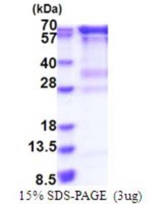 SDS-Page: RNGTT Recombinant Protein [NBP2-51817] - 15% SDS Page (3 ug)