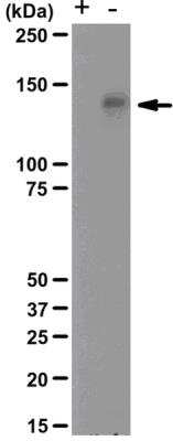 Western Blot: RNMT [p Tyr1235] Antibody (NL8) [NBP2-29685] - Untreated (Lane -) and lambda-phosphatase treated (Lane +) RIPA lysate from A431 cells co-expressing Met/HGFR and HGF were resolved by electrophoresis, transferred to PVDF and probed with anti-phospho-Met (Tyr1234/1235), clone NL8.Arrow indicates phospho-Met (~140 kDa).