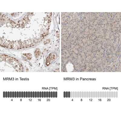 <b>Orthogonal Strategies Validation. </b>Immunohistochemistry-Paraffin: RNMTL1 Antibody [NBP1-83844] - Staining in human testis and pancreas tissues using anti-MRM3 antibody. Corresponding MRM3 RNA-seq data are presented for the same tissues.