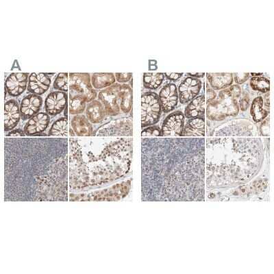 <b>Independent Antibodies Validation. </b>Immunohistochemistry-Paraffin: RNMTL1 Antibody [NBP1-83844] - Staining of human colon, kidney, lymph node and testis using Anti-MRM3 antibody NBP1-83844 (A) shows similar protein distribution across tissues to independent antibody NBP1-83845 (B).