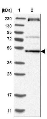 Western Blot: RNMTL1 Antibody [NBP1-83845] - Lane 1: Marker  [kDa] 230, 130, 95, 72, 56, 36, 28, 17, 11.  Lane 2: Human cell line RT-484