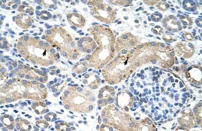 Immunohistochemistry-Paraffin RNPC1 Antibody