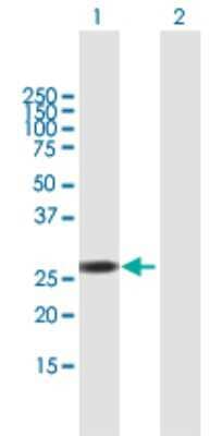Western Blot: RNPC1 Antibody [H00055544-B02P] - Analysis of RBM38 expression in transfected 293T cell line by RBM38 polyclonal antibody.  Lane 1: RNPC1 transfected lysate(26.29 KDa). Lane 2: Non-transfected lysate.