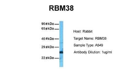 Western Blot RNPC1 Antibody