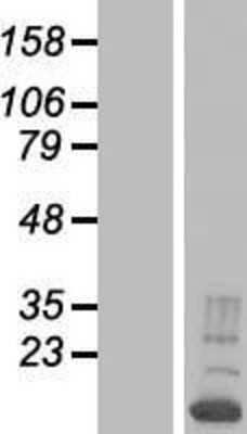 Western Blot RNPC1 Overexpression Lysate