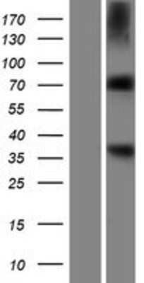 Western Blot: Aminopeptidase B/RNPEP Overexpression Lysate [NBP2-06674] - Left-Empty vector transfected control cell lysate (HEK293 cell lysate); Right -Over-expression Lysate for RNPEP.