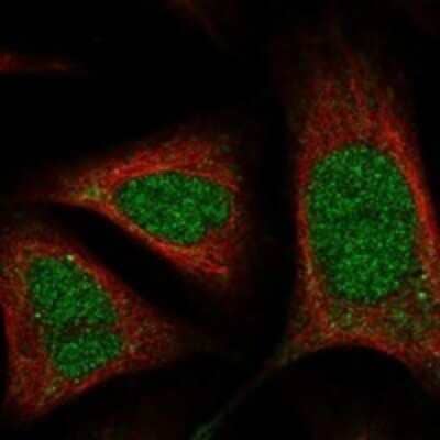 Immunocytochemistry/Immunofluorescence: RNase H1 Antibody [NBP3-17926] - Staining of human cell line U-2 OS shows localization to nucleoplasm & cytosol.