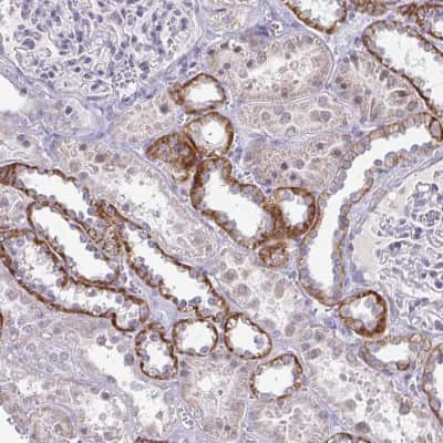 Immunohistochemistry: RNase H1 Antibody [NBP2-38501] - Staining of human kidney shows strong cytoplasmic positivity in distal tubules.