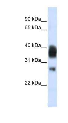 Western Blot: RNase H1 Antibody [NBP1-80448] - Titration: 0.2-1 ug/ml, Positive Control: Jurkat cell lysate.