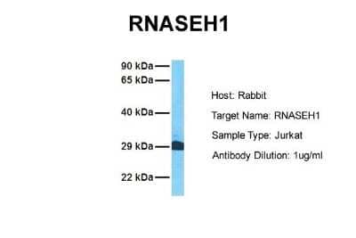 Western Blot: RNase H1 Antibody [NBP1-80448] - Sample Tissue: Human Jurkat Antibody Dilution: 1.0 ug/ml