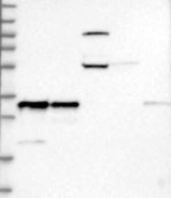 Western Blot: RNase H1 Antibody [NBP3-17926] - Lane 1: Marker [kDa] 230, 130, 95, 72, 56, 36, 28, 17, 11;   Lane 2: RT4;   Lane 3: U-251 MG;   Lane 4: Human Plasma;   Lane 5: Liver;   Lane 6: Tonsil