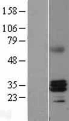 Western Blot: RNase H1 Overexpression Lysate (Adult Normal) [NBL1-15399] Left-Empty vector transfected control cell lysate (HEK293 cell lysate); Right -Over-expression Lysate for RNase H1.