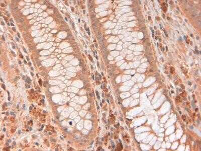 Immunohistochemistry: RNase L Antibody (2E9) - Azide and BSA Free [NBP2-80929] - RNase L antibody was tested in human colon using DAB with hematoxylin counterstain. Image from the standard format of this antibody.