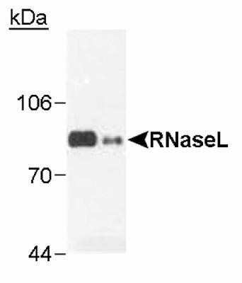 Western Blot: RNase L Antibody (2E9) - Azide and BSA Free [NBP2-80929] - RNaseL in insect cell extracts transfected with recombinant human RNase L (0.1 ug) and Hey1B (100 ug) Image from the standard format of this antibody.