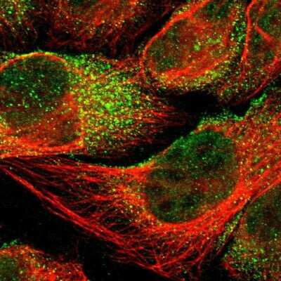 Immunocytochemistry/Immunofluorescence: ROBLD3 Antibody [NBP1-87951] - Immunofluorescent staining of human cell line U-2 OS shows localization to nucleoplasm & vesicles.