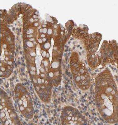 Immunohistochemistry-Paraffin: ROBLD3 Antibody [NBP1-87951] - Staining of human colon shows strong cytoplasmic positivity in glandular cells.