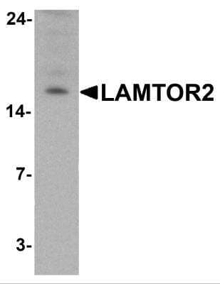 Western Blot ROBLD3 Antibody - BSA Free