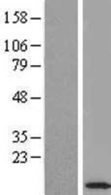 Western Blot: ROBLD3 Overexpression Lysate (Adult Normal) [NBL1-12864] Left-Empty vector transfected control cell lysate (HEK293 cell lysate); Right -Over-expression Lysate for ROBLD3.