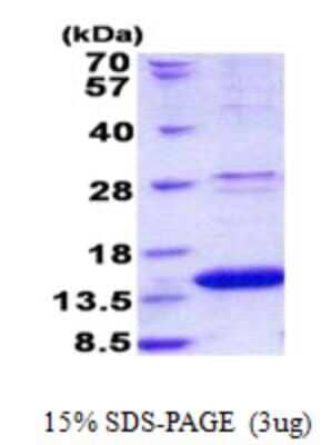 SDS-Page: ROBLD3 Protein [NBP2-23179]