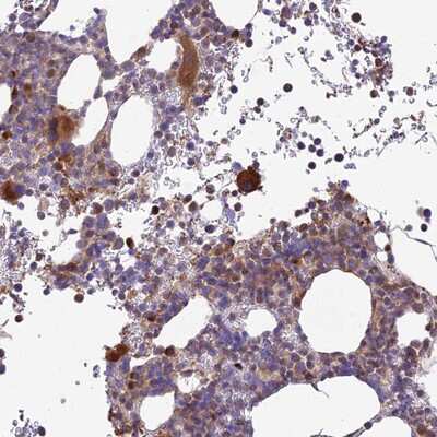 Immunohistochemistry-Paraffin: ROCK1 Antibody [NBP2-13244] Staining of human bone marrow shows strong cytoplasmic positivity in hematopoietic cells.