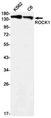 Western Blot: ROCK1 Antibody (S06-9A5) [NBP3-19762] - Western blot detection of ROCK1 in K562, C6 cell lysates using NBP3-19762 (1:1000 diluted). Predicted band size: 158kDa. Observed band size: 158kDa.