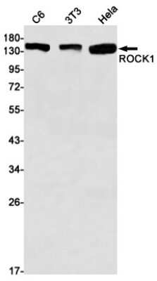 Western Blot: ROCK1 Antibody (S09-3D3) [NBP3-14972] - Western blot detection of ROCK1 in C6, 3T3, Hela cell lysates using ROCK1 Rabbit mAb (1:1000 diluted). Predicted band size: 158kDa. Observed band size: 158kDa.