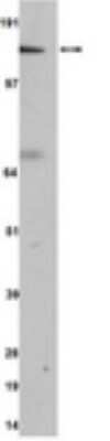 Western Blot: ROCK2 Antibody (A9W4) [NBP2-29776] - PC12 cell lysate was resolved by electrophoresis, transferred to PVDF, and probed with anti-ROKalpha /ROCK-II, clone A9W4 (1:500 dilution).  Proteins were visualized using an anti-rabbit secondary antibody conjugated to HRP and a chemiluminescence detection system.  Arrow indicates ROKalpha / ROCK-II (~150 kDa).