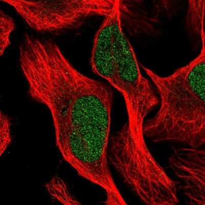 Immunocytochemistry/ Immunofluorescence ROD1 Antibody - BSA Free