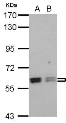 Western Blot: ROD1 Antibody [NBP2-15101] - Sample (30 ug of whole cell lysate) A: NT2D1 B: PC-3 7.5% SDS PAGE; antibody diluted at 1:1000.