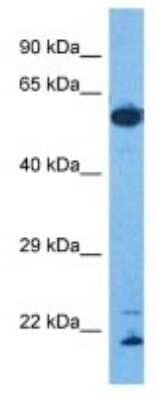 Western Blot: ROD1 Antibody [NBP3-09994] - Western blot analysis of ROD1 in Human Stomach Tumor. Antibody dilution at 1.0ug/ml
