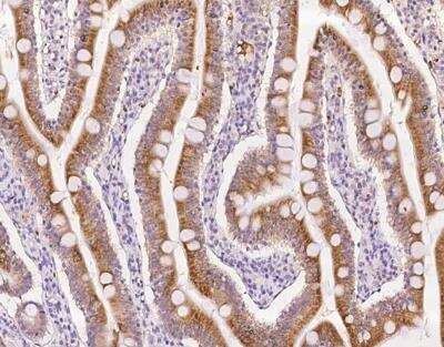 Immunohistochemistry-Paraffin: ROGDI Antibody [NBP3-12690] - Staining of human ROGDI in human small intestine with rabbit polyclonal antibody at 1:100 dilution.