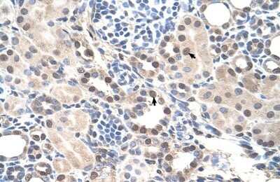 Immunohistochemistry-Paraffin: ROR alpha/NR1F1 Antibody [NBP1-52828] - Human kidney Tissue, antibody concentration 4-8ug/ml. Cells with positive label: renal corpuscle cells (indicated with arrows) 400X magnification.