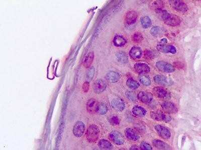 Immunohistochemistry-Paraffin: ROR alpha/NR1F1 Antibody [NLS2337] - Human, Skin: Formalin-Fixed Paraffin-Embedded (FFPE)