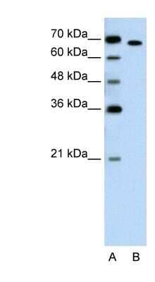 Western Blot: ROR alpha/NR1F1 Antibody [NBP1-52828] - Jurkat cell lysate, Antibody Titration: 1.25ug/ml