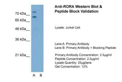 Western Blot: ROR alpha/NR1F1 Antibody [NBP1-52828] - Sample Tissue: Jurkat, Lane A: Primary Antibody, Lane B: Primary Antibody + Blocking Peptide, Primary Antibody Concentration: 2.5ug/mL, Peptide Concentration: 2.0ug/mL, Lysate Quantity: 25ug/lane, Gel Concentration: 12%