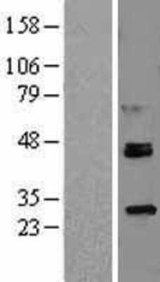 Western Blot: ROR alpha Overexpression Lysate (Adult Normal) [NBL1-15479] Left-Empty vector transfected control cell lysate (HEK293 cell lysate); Right -Over-expression Lysate for ROR alpha.