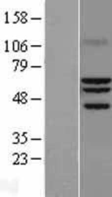 Western Blot: ROR alpha Overexpression Lysate (Adult Normal) [NBL1-15480] Left-Empty vector transfected control cell lysate (HEK293 cell lysate); Right -Over-expression Lysate for ROR alpha.