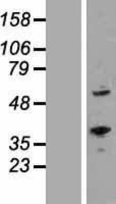 Western Blot: ROR alpha Overexpression Lysate (Adult Normal) [NBP2-05658] Left-Empty vector transfected control cell lysate (HEK293 cell lysate); Right -Over-expression Lysate for ROR alpha.