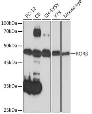 Western Blot: ROR beta Antibody (7J9T7) [NBP3-15895] - Western blot analysis of extracts of various cell lines, using ROR beta Rabbit mAb (NBP3-15895) at 1:1000 dilution. Secondary antibody: HRP Goat Anti-Rabbit IgG (H+L) at 1:10000 dilution. Lysates/proteins: 25ug per lane. Blocking buffer: 3% nonfat dry milk in TBST. Detection: ECL Basic Kit. Exposure time: 60s.