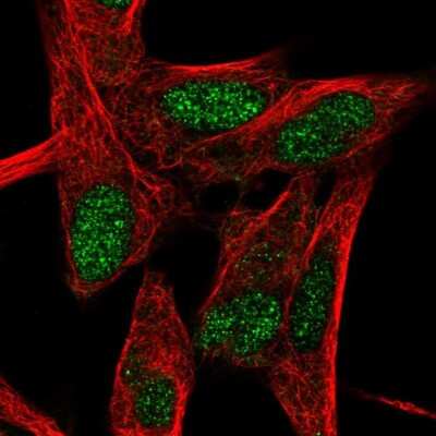 Immunocytochemistry/Immunofluorescence: ROR beta Antibody [NBP1-82532] - Staining of human cell line SH-SY5Y shows localization to nucleus. Antibody staining is shown in green.