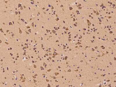 Immunohistochemistry-Paraffin: ROR beta Antibody [NBP2-97604] - Staining of human ROR beta in human brain with rabbit polyclonal antibody at 1:100 dilution.