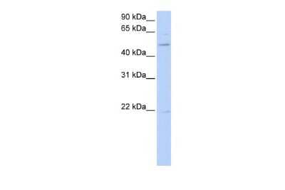 Western Blot: ROR beta Antibody [NBP2-88172] - WB Suggested Anti-RORB Antibody Titration: 0.2-1 ug/ml. ELISA Titer: 1:312500. Positive Control: Transfected 293T