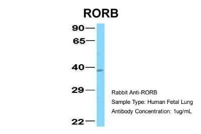 Western Blot ROR beta Antibody - BSA Free