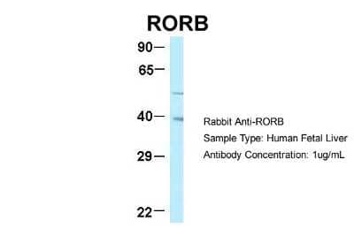 Western Blot: ROR beta Antibody [NBP2-88172] - Host: Rabbit. Target Name: RORB. Sample Type: Human Fetal Liver. Antibody Dilution: 1.0ug/ml