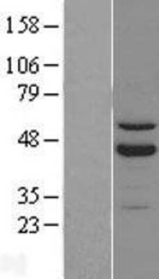 Western Blot ROR beta Overexpression Lysate