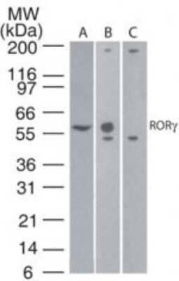 Western Blot: ROR gamma/RORC/NR1F3 Antibody (4G419) - Azide and BSA Free [NBP2-80930] - Analysis in (A) human thymus lysate, (B) transfected 293 cell lysate, and (C) untransfected 293 cell lysate. Dilution: 5 ug/ml. Image from the standard format of this antibody.